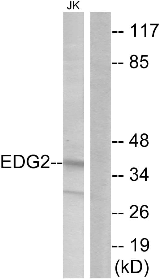 IHC-plus™ LPAR1 / LPA1 / EDG2 Antibody (aa5-54)