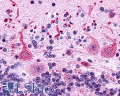PathPlus™ GPR162 Antibody (Extracellular Domain)
