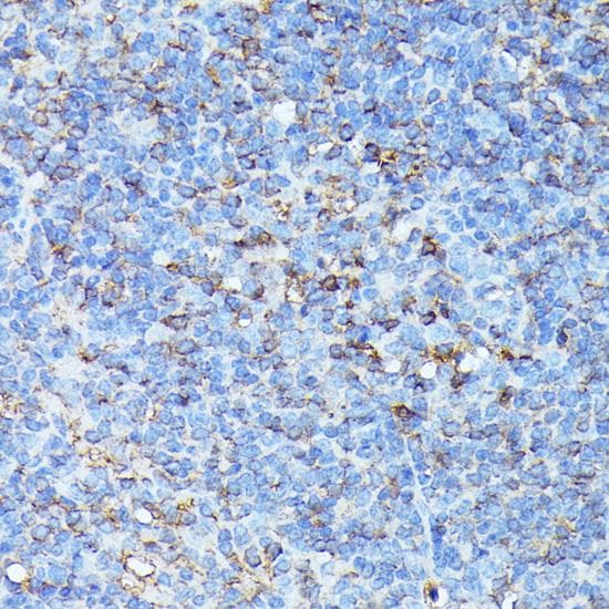 Polyclonal Rabbit anti-Human CXCR1 Antibody (IHC, WB)