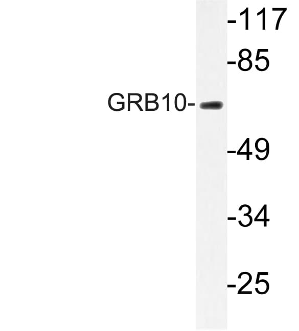GRB10 Antibody (Leu63)