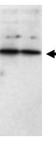 IHC-plus™ SFRP1 Antibody