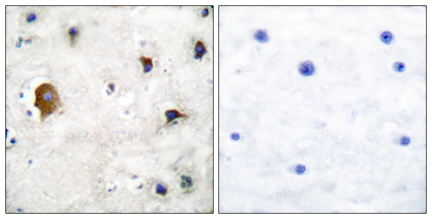 Polyclonal Rabbit anti-Human GJA1 / CX43 / Connexin 43 Antibody (IHC, IF, WB)