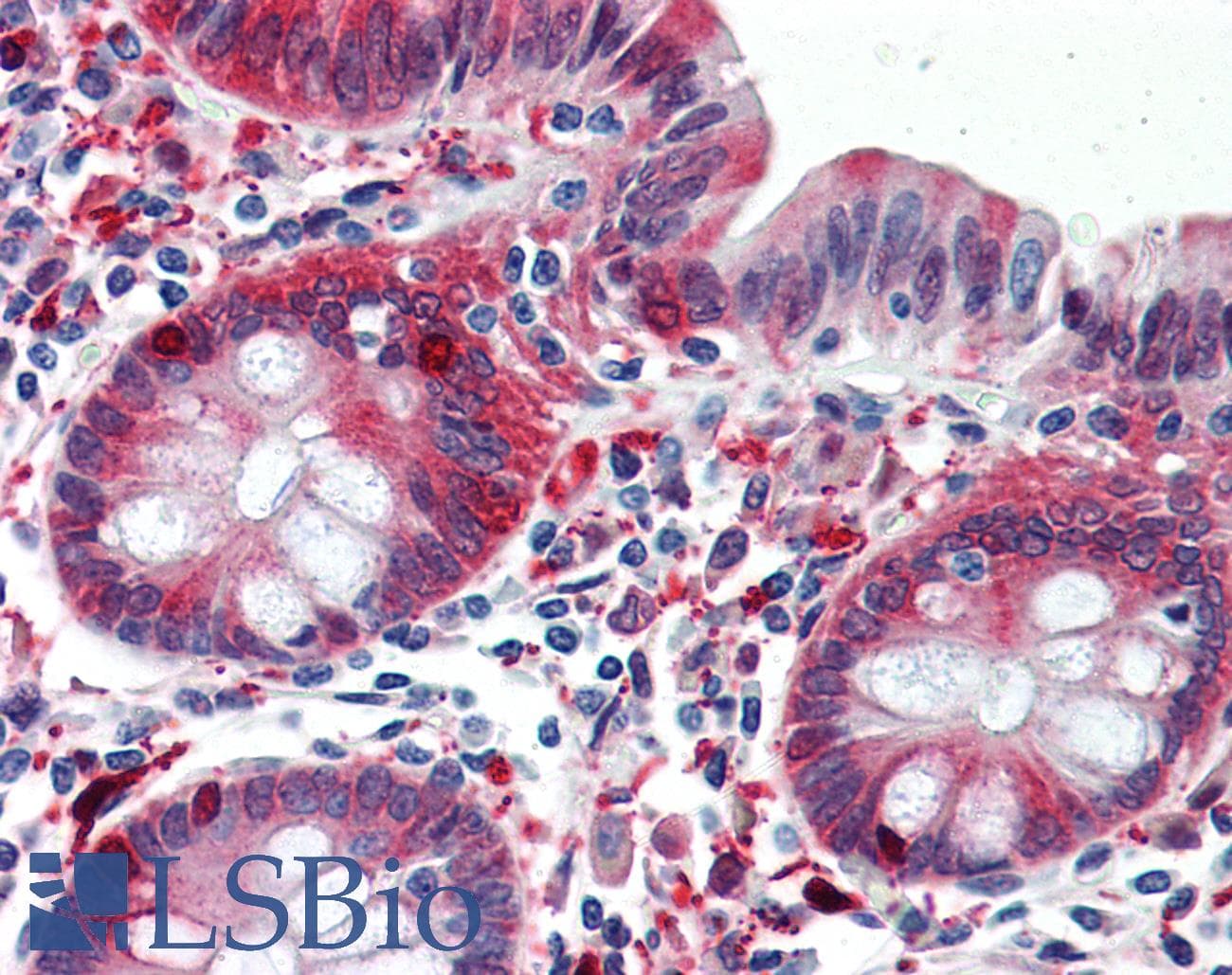 PathPlus™ ALDH1A1 / ALDH1 Antibody (clone 1G6)
