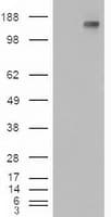 PTCH1 / Patched 1 Antibody (clone OTI3c2)