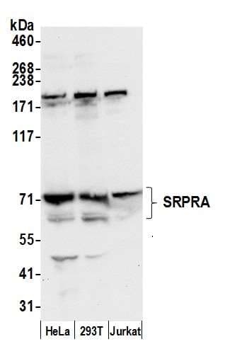 Polyclonal Rabbit anti-Human SRPR Antibody (aa125-175, WB)