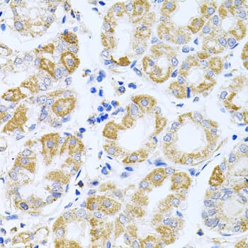 IRS1 Antibody