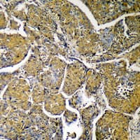 ACLY / ATP Citrate Lyase Antibody (Internal)