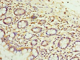 SULT1E1 / Sulfotransferase 1E1 Antibody