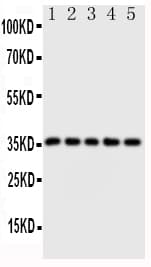 Polyclonal Rabbit anti-Human FOSB Antibody (aa1-15, WB)