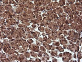 Monoclonal Mouse anti-Human TRIM44 Antibody (clone OTI1E10, IHC, IF, WB)