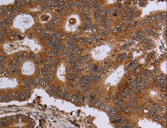 HSD17B4 Antibody