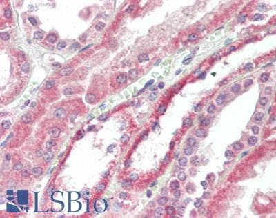 IHC-plus™ CSRP2BP Antibody