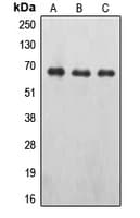 EPOR / EPO Receptor Antibody (phospho-Tyr426)