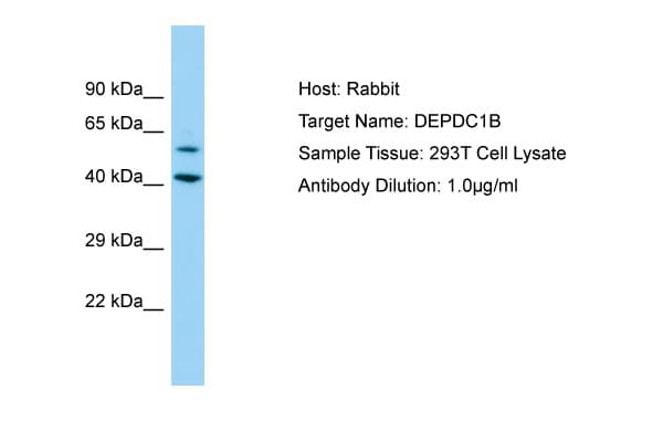 Polyclonal Rabbit anti-Human DEPDC1B Antibody (aa87-136, WB)