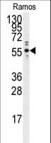 Polyclonal Rabbit anti-Human PTP1B Antibody (aa1-321, WB)