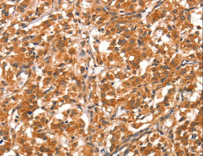 DAB2IP Antibody