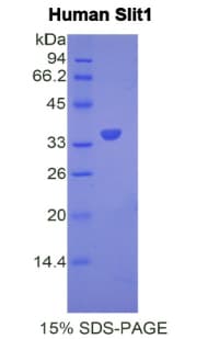 Human SLIT1 Protein (Recombinant His)