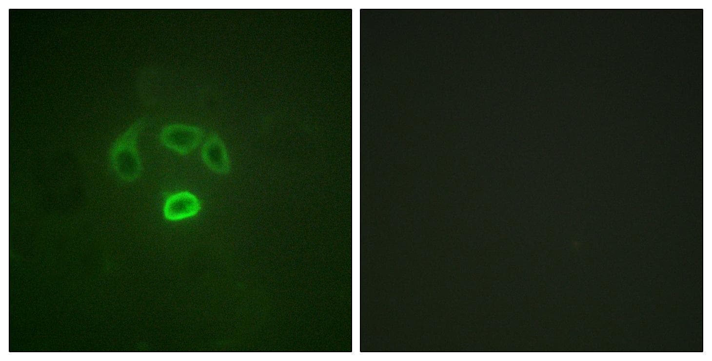 GRB10 Antibody (phospho-Tyr67)