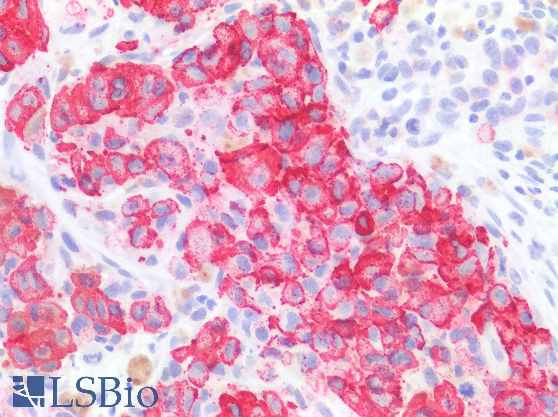 IHC-plus™ HMB45 Antibody (clone HMB45)