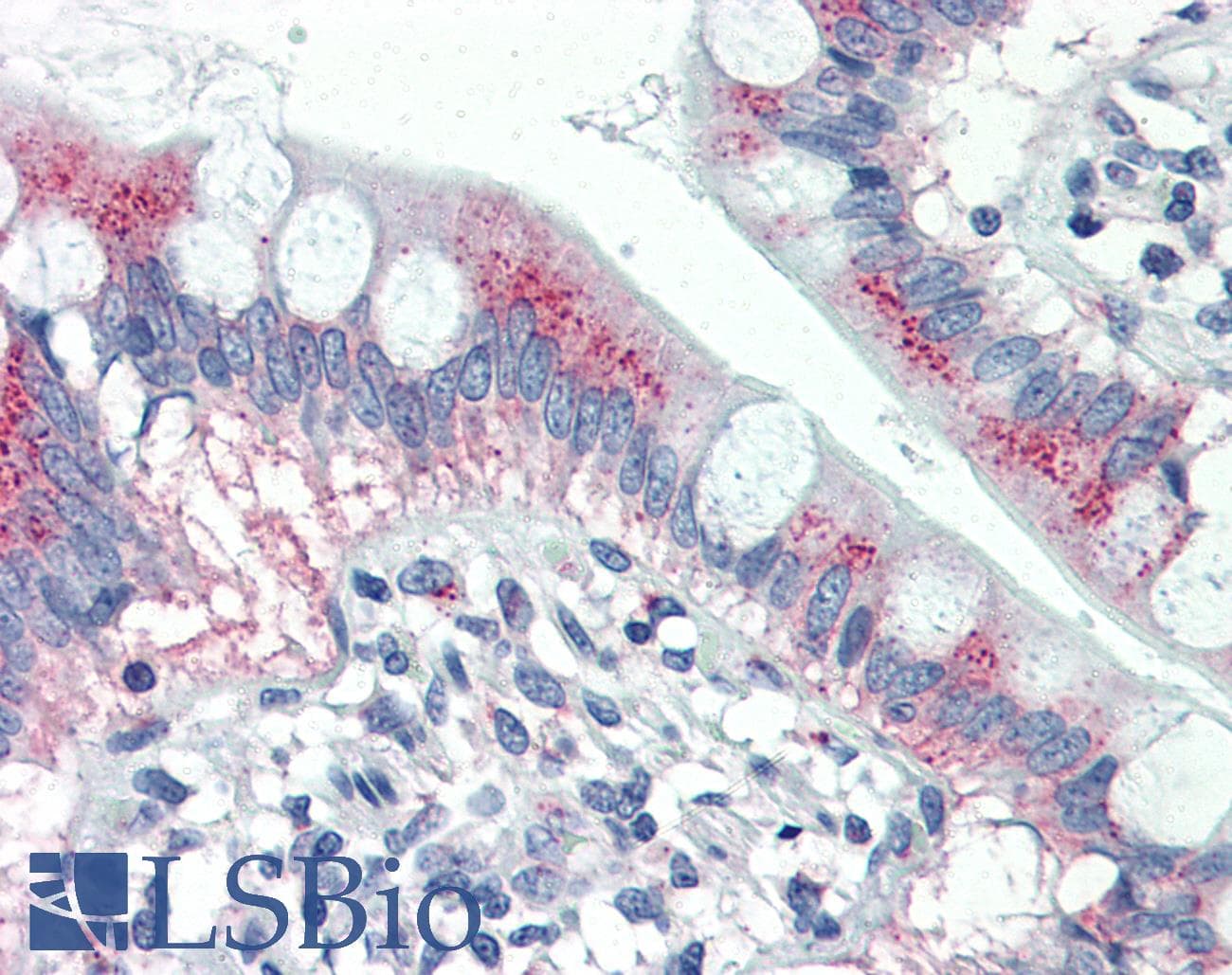 IHC-plus™ MUC5AC Antibody (clone CLH2)