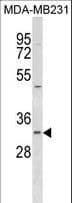 FAHD2A Antibody (aa272-298)