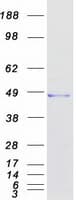 Human ARMC8 Protein (Recombinant Myc-DDK (Flag))