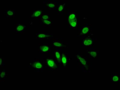 Polyclonal Rabbit anti-Human HIST1H3A Antibody (IHC, IF)