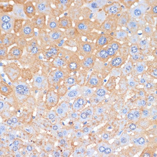 APCS / Serum Amyloid P / SAP Antibody