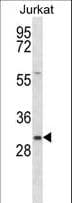 Polyclonal Rabbit anti-Human TMED8 Antibody (aa154-182, WB)
