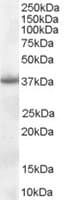 IHC-plus™ Polyclonal Goat anti-Human NPM1 / NPM / Nucleophosmin Antibody (aa281-294, IHC, WB)