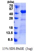 Human DNAJB4 Protein (Recombinant His)