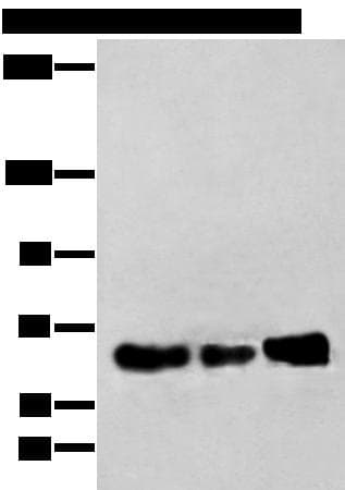 Polyclonal Rabbit anti-Human ZBTB5 Antibody (WB)