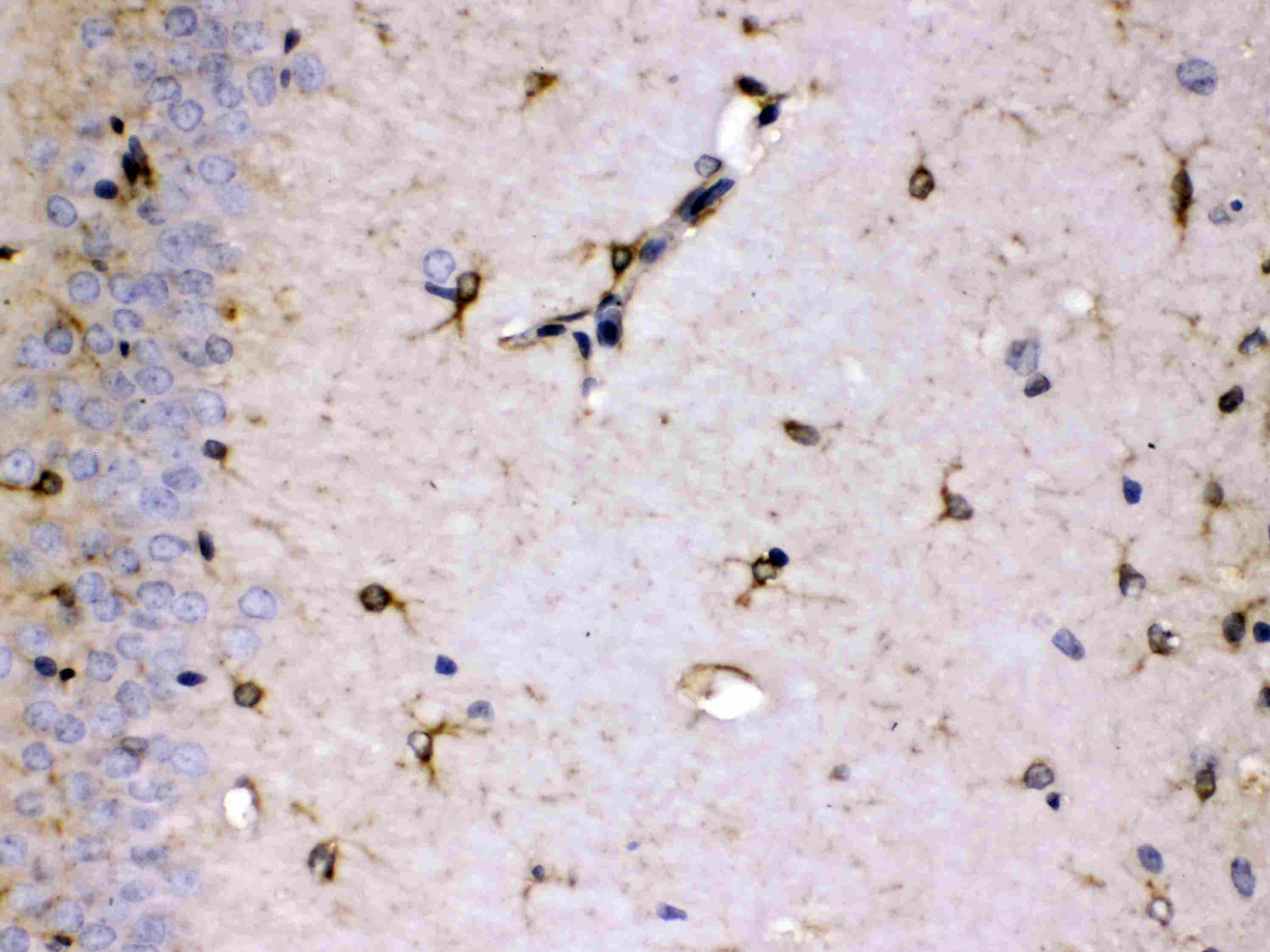 Polyclonal Rabbit anti-Human ALDH7A1 Antibody (IHC, WB)