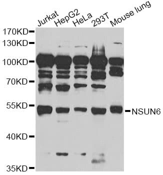 Polyclonal Rabbit anti-Human NSUN6 Antibody (IF, WB)
