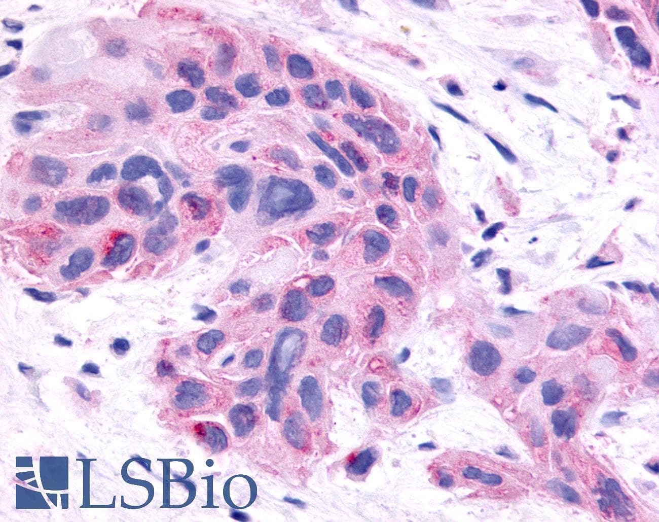 PathPlus™ Polyclonal Rabbit anti-Human NR0B2 Antibody (Ligand-binding Domain, IHC, IF)