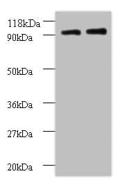 RPS12 / Ribosomal Protein S12 Antibody