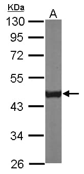 IHC-plus™ CS / Citrate Synthase Antibody (Internal)