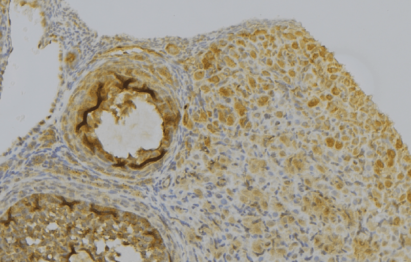 PRDX6 / Peroxiredoxin 6 Antibody