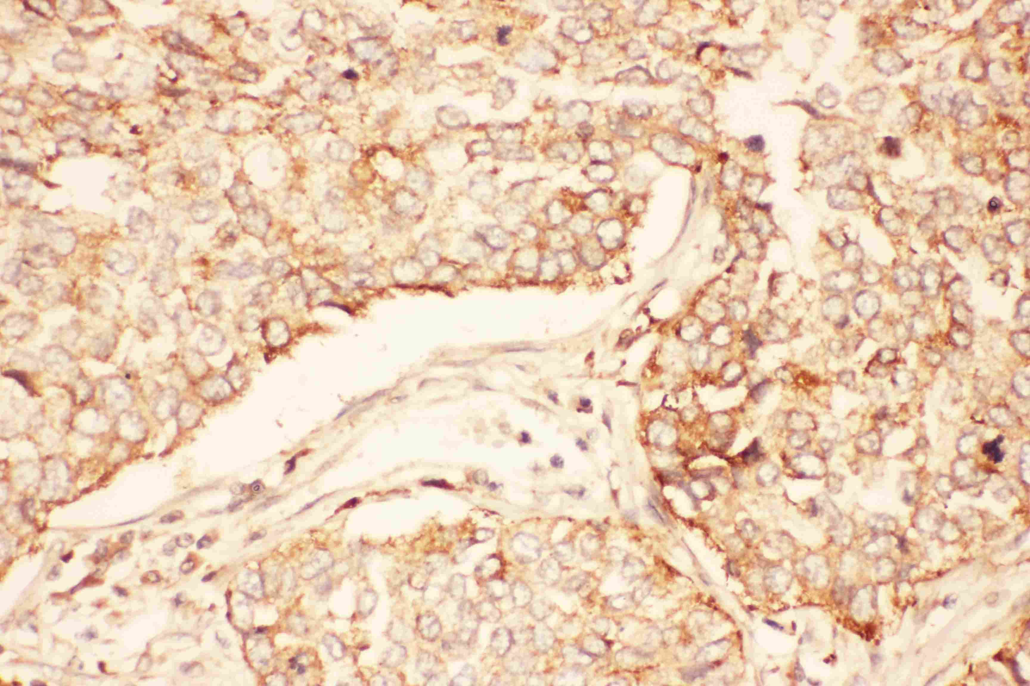 AKT2 Antibody (aa454-481)