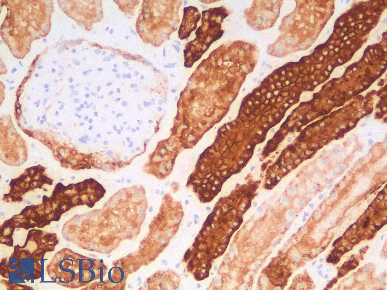 PathPlus™ EPCAM Antibody (clone EGP40/1556R)