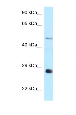 Polyclonal Rabbit anti-Rat AGPAT9 / MAG1 Antibody (aa199-248, WB)