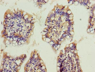 OSER1 / C20orf111 Antibody