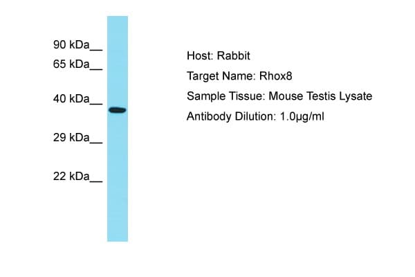 Rhox8 Antibody (aa180-229)