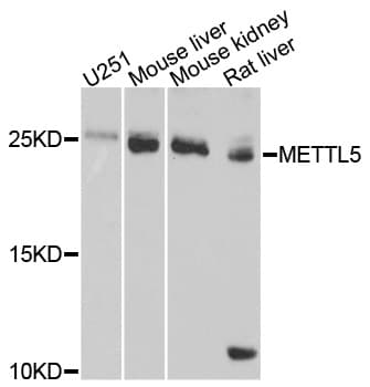 HSPC133 / METTL5 Antibody
