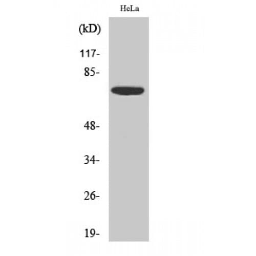 EIF2AK2 / PKR Antibody (380-460 aa)