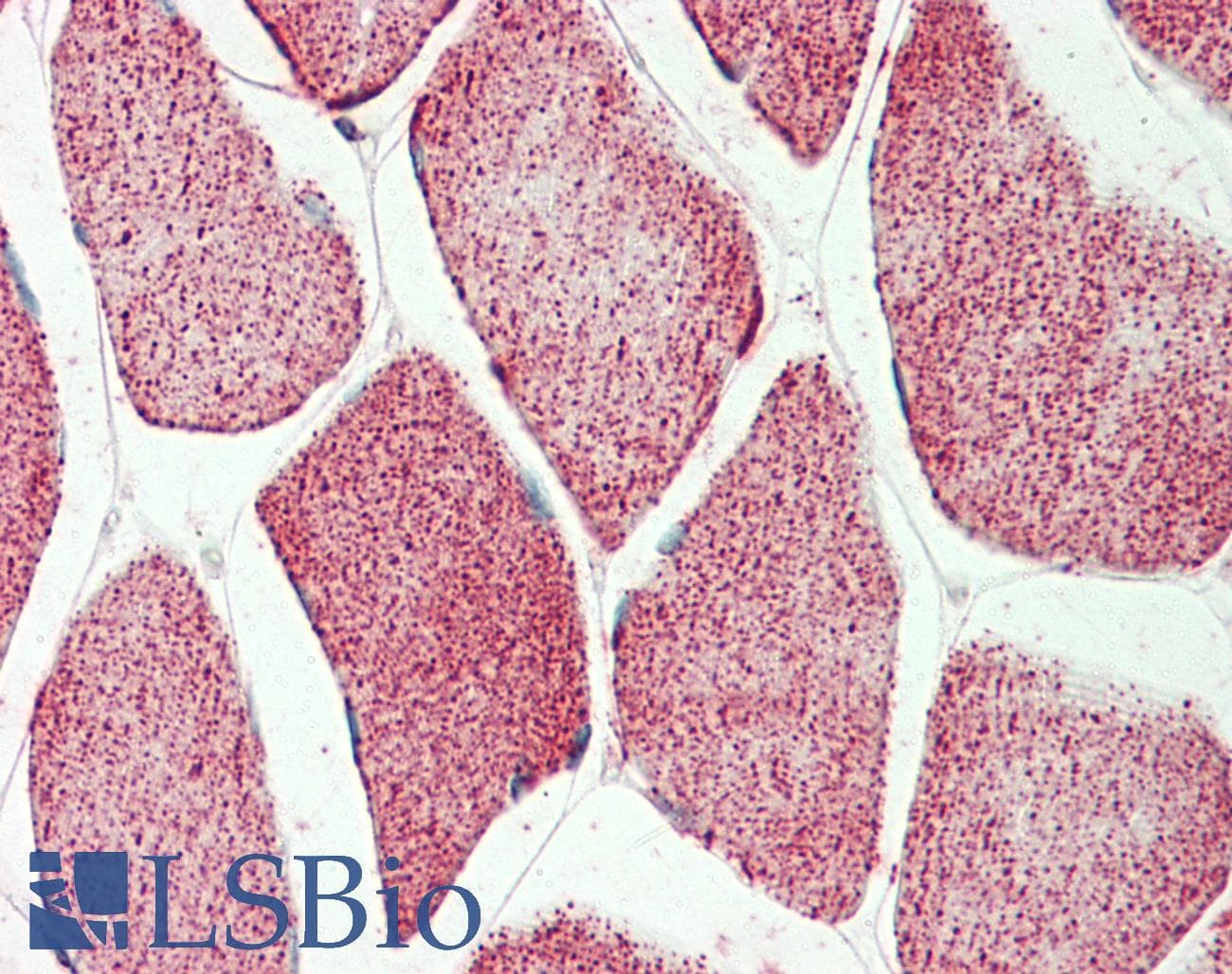 IHC-plus™ Polyclonal Goat anti-Human ATP5A1 / ATP Synthase Alpha Antibody (aa83-94, IHC, WB)