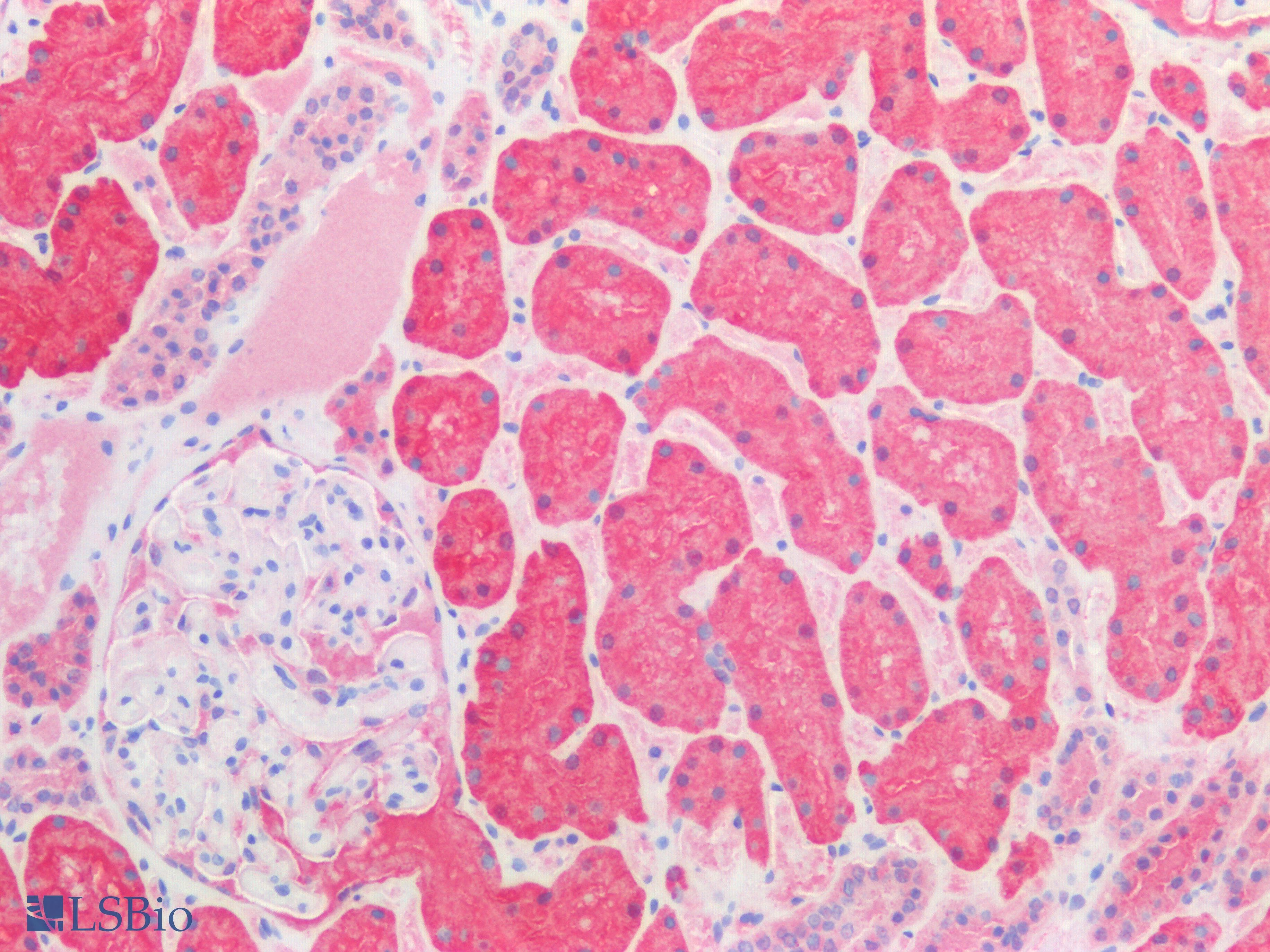 PathPlus™ HSPD1 / HSP60 Antibody (C-Terminus)