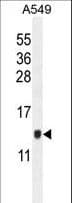 KRTCAP2 Antibody (aa134-162)