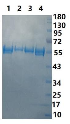 Coronavirus SARS-CoV-2 SARS-CoV-2 Nucleoprotein (Recombinant His,N-terminus)