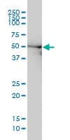 DDX6 Antibody (clone 3D2)